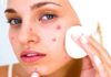 चेहरे के दाग धब्बे कैसे हटाए-घरेलू उपाय home remedies for removing face spots