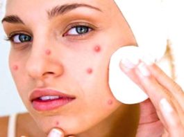 home remedies for removing face spots