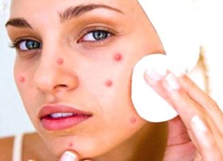 चेहरे के दाग धब्बे कैसे हटाए-घरेलू उपाय home remedies for removing face spots