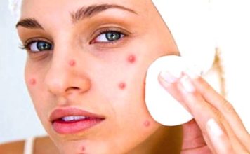 चेहरे के दाग धब्बे कैसे हटाए-घरेलू उपाय home remedies for removing face spots
