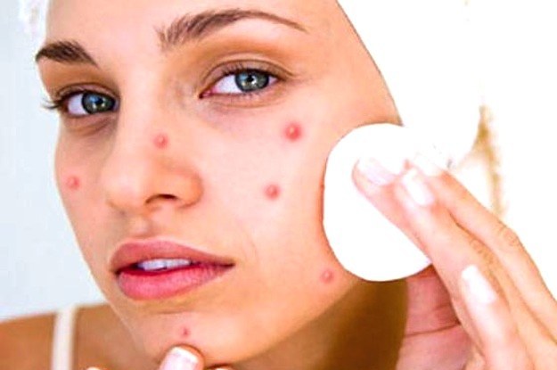 home remedies for removing face spots