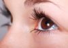 आँखों की झुरिया से पाए निजात get rid of wrinkles around the eyes