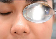 आँखों की सुजन हटाने के उपाय remedies to cure Inflammation of the eye