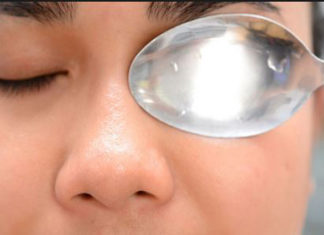 आँखों की सुजन हटाने के उपाय remedies to cure Inflammation of the eye