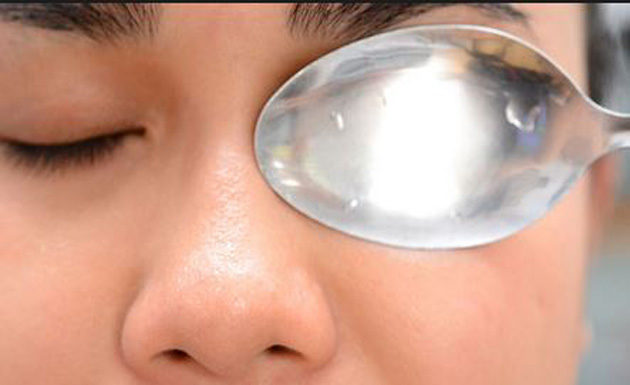 आँखों की सुजन हटाने के उपाय remedies to cure Inflammation of the eye