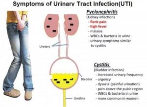 home remedies to relieve irritation