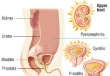 पेसाब मैं जलन को दूर करने के घरेलू नुस्खे home remedies to relieve irritation