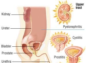 पेसाब मैं जलन को दूर करने के घरेलू नुस्खे home remedies to relieve irritation