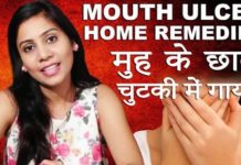 मुंह के छाले का घरेलू उपाय home remedy for mouth ulcers