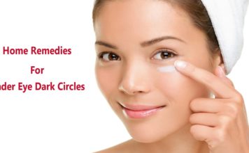 आंखों के नीचे डार्क सर्कल Dark circles under eyes