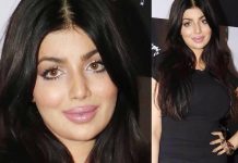 लिप सर्जरी कराने के बाद कुछ इस प्रकार नज़र आ रही हैं आयेशा टाकिया ,देखें तस्वीरें Ayesha Takia look like this after Lip surgery