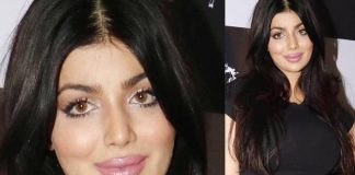 लिप सर्जरी कराने के बाद कुछ इस प्रकार नज़र आ रही हैं आयेशा टाकिया ,देखें तस्वीरें Ayesha Takia look like this after Lip surgery