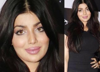 लिप सर्जरी कराने के बाद कुछ इस प्रकार नज़र आ रही हैं आयेशा टाकिया ,देखें तस्वीरें Ayesha Takia look like this after Lip surgery