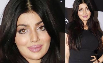 लिप सर्जरी कराने के बाद कुछ इस प्रकार नज़र आ रही हैं आयेशा टाकिया ,देखें तस्वीरें Ayesha Takia look like this after Lip surgery