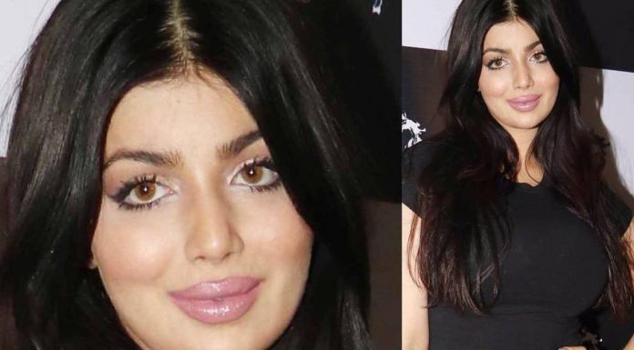 लिप सर्जरी कराने के बाद कुछ इस प्रकार नज़र आ रही हैं आयेशा टाकिया ,देखें तस्वीरें Ayesha Takia look like this after Lip surgery