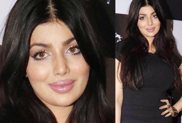 Ayesha Takia look like this after Lip surgery