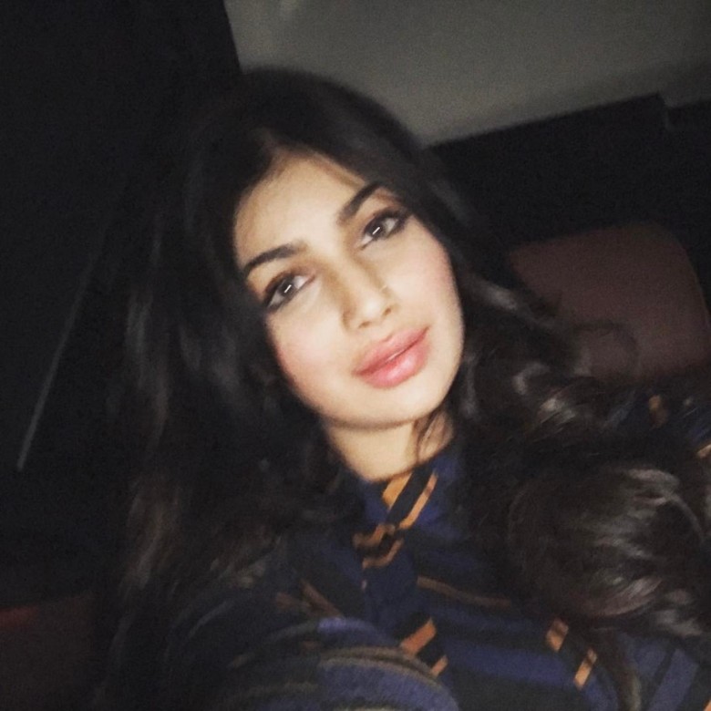  Ayesha Takia look like this after Lip surgery 