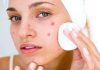 पिम्पल्स हटाने के घरेलू इलाज Home Remedies for Pimples Removal