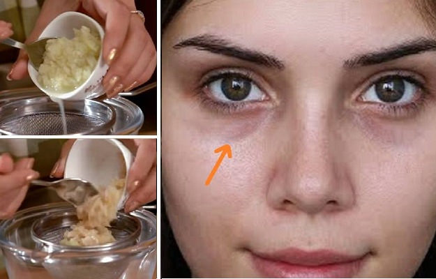 Remove lip darkness in 2 minutes