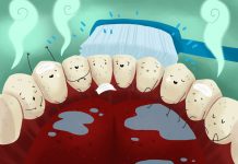 tips for cleaning teeth for people eating tobacco and gutkha