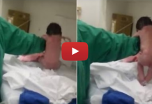 इस बच्चे के जन्म के बाद हुआ कुछ ऐसा कि खुद डॉक्टर भी गए चौंक ! देखें रोंगटे खड़े कर देने वाला वीडियो