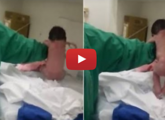 इस बच्चे के जन्म के बाद हुआ कुछ ऐसा कि खुद डॉक्टर भी गए चौंक ! देखें रोंगटे खड़े कर देने वाला वीडियो