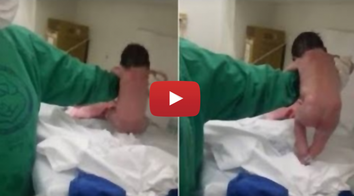 इस बच्चे के जन्म के बाद हुआ कुछ ऐसा कि खुद डॉक्टर भी गए चौंक ! देखें रोंगटे खड़े कर देने वाला वीडियो